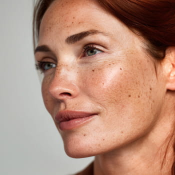 SERVICES_Dark Spot Removal